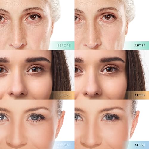 Facial Serum Trio Set Value for Clear Skin - Vitamin C Super Serum, 2.5% Retinol Serum, Pure Hyaluronic Acid Serum – Vegan, Cruelty-Free Skincare 3 pack