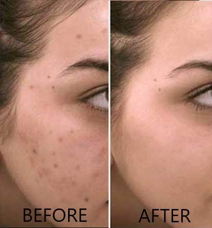 Vitamin C Serum 20% Pure L-Ascorbic Acid, Ferulic Acid, Vitamin E and Hyaluronic Acid for Face and Eyes Natural Anti Aging Anti Wrinkle 1oz.