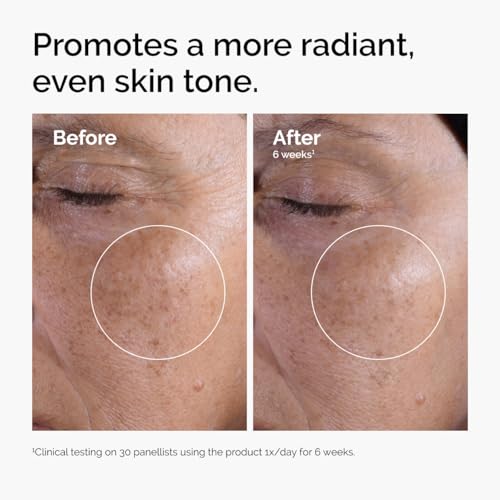 The Ordinary Glycolic Acid 7% Exfoliating Toner, Brightening and Smoothing Daily Toner for More Even-Looking Skin Tone, 8.1 Fl Oz