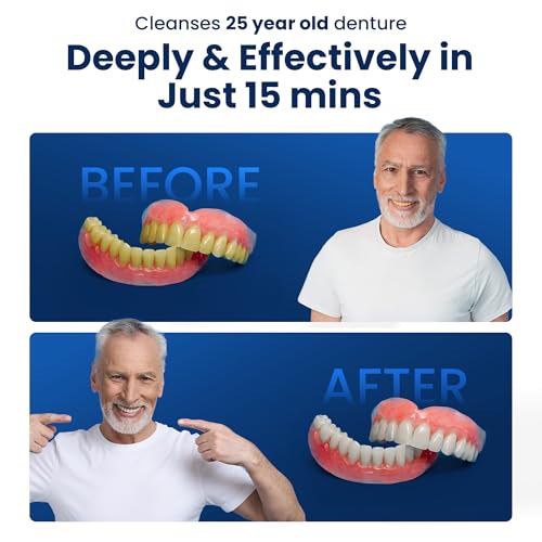 F3900 Ultrasonic Denture/Aligner/Retainer Cleaner for all dental and sleep apnea appliances, 110V 20W (tank no longer removable) , White , 0.4Pt/0.2L