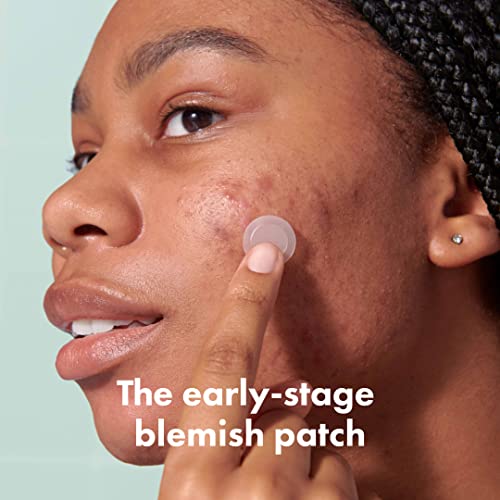 Micropoint™ for Blemishes from Hero Cosmetics - Hydrocolloid Acne Spot Treatment Patch for Early Stage Zits and Hidden Pimples, 395 Micropoints (8 Patches)