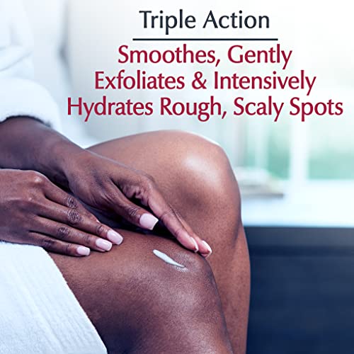 Roughness Relief Spot Treatment, Urea Enriched Body Moisturizer for Dry Skin, Rough and Scaly Spots, With Precision Tip for Targeted Application, 2.7 Oz Tube
