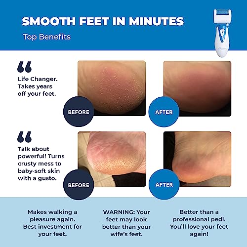 Electric Callus Remover: Professional Pedicure Tools Foot Care for Women, Rechargeable Foot Scrubber, CR900 Electronic Feet File Pedi Sander Best for Hard Cracked Dry Dead Skin, 3 Rollers