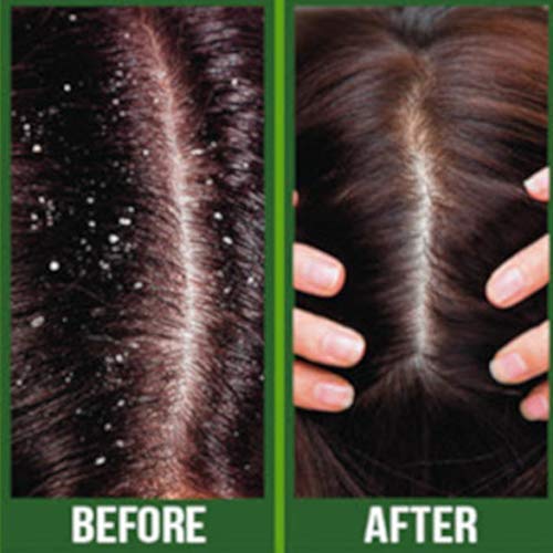 Premium Castor Plus Tea Tree - Pro-Growth + Scalp Care Premium Hair Oil 2.5 oz.