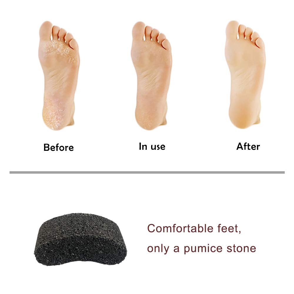 Natural Lava Pumice Stone, Pedicure Tool, Hard Callus Dead Skin Remover, Foot File for Exfoliation & Fine Foot Scrubber for Smoothing & Softening Skin…