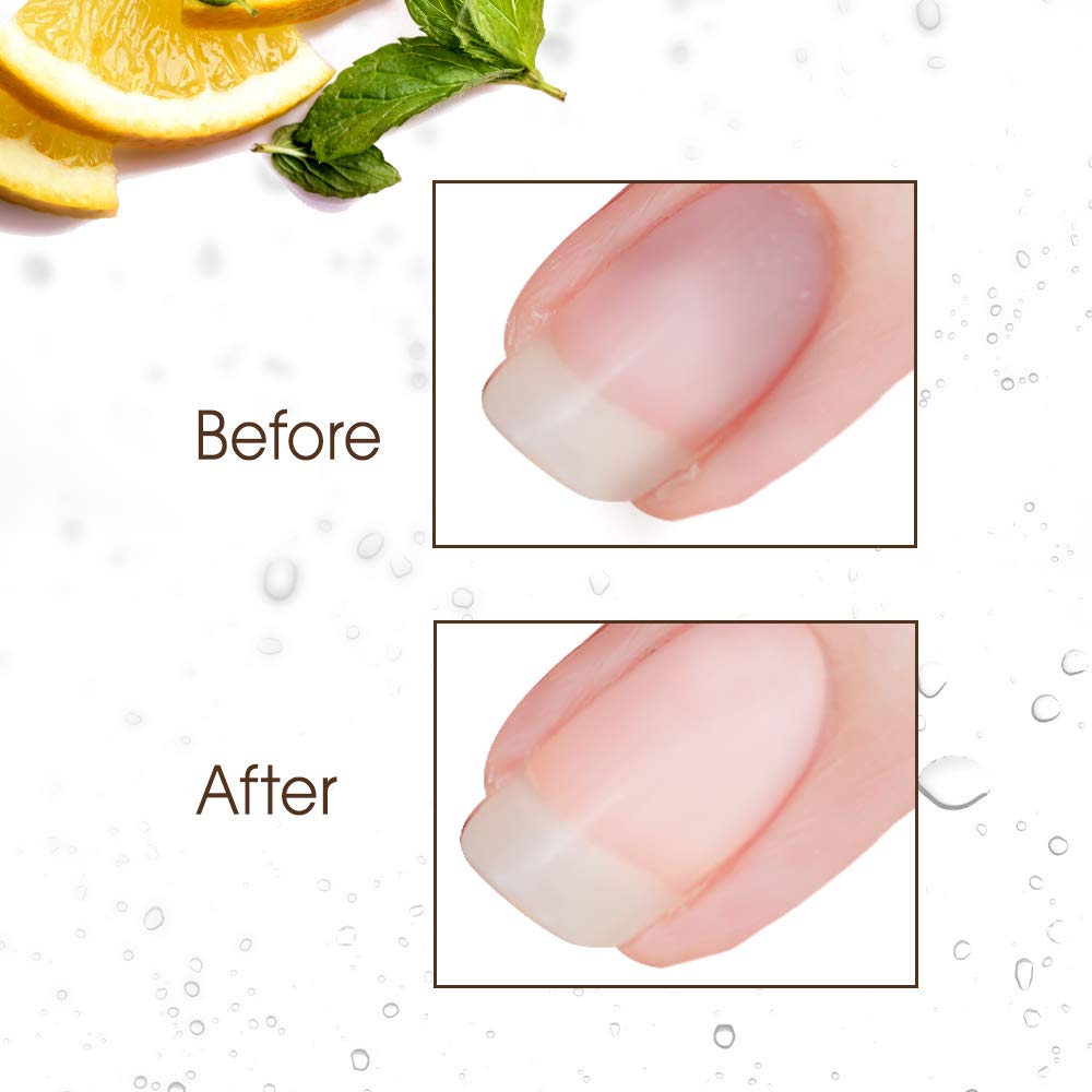 Nail Brite Whitening Scrub with Brush, Cleans Conditions & Brightens Nails, 4 oz