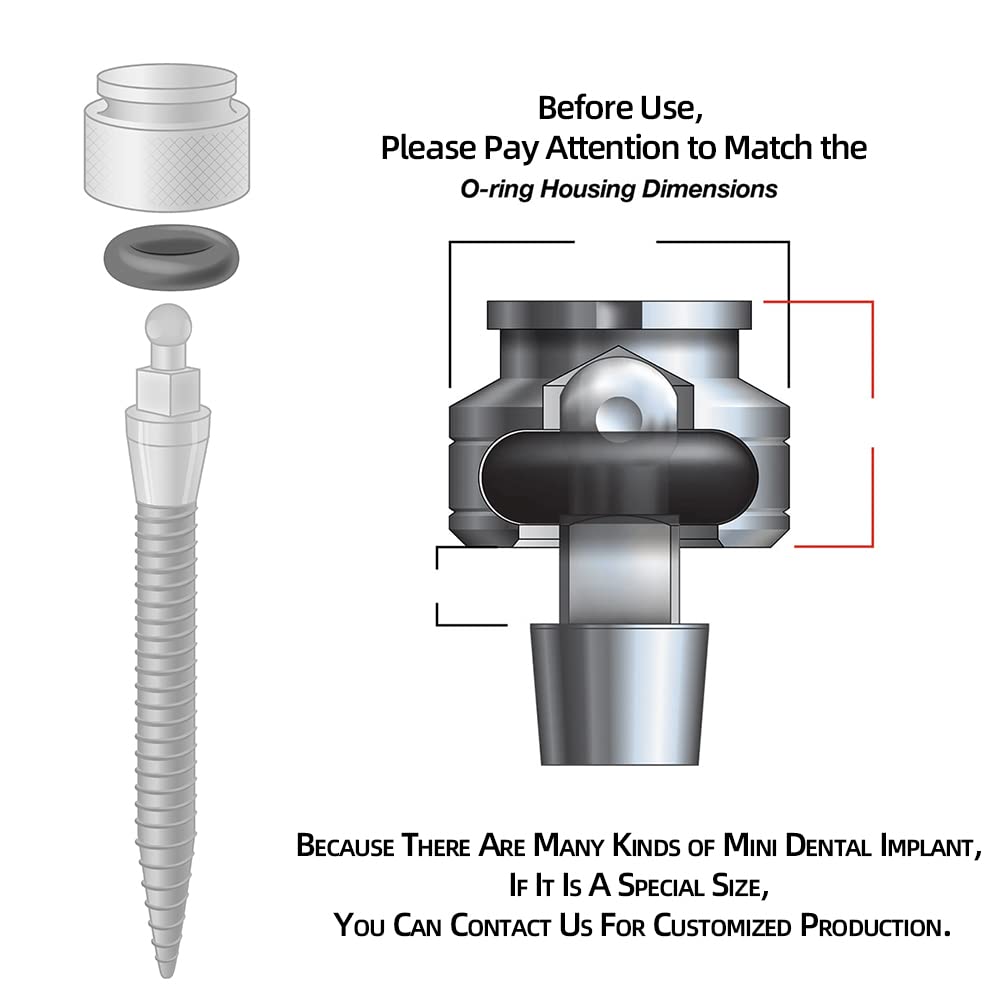 O-Ring, Buna-n, Tool Kit with 3 Convenient Sizes, Replacement for Mini Dental Implants
