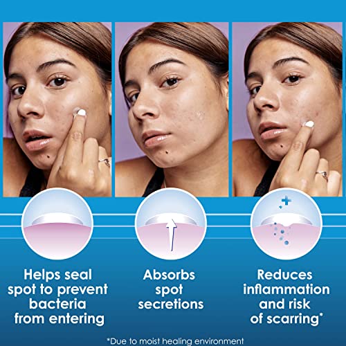 Overnight Spot Patches, Advanced Healing Hydrocolloid Acne Pimple Treatment, Blemish Spot Stickers for Face, 18 count