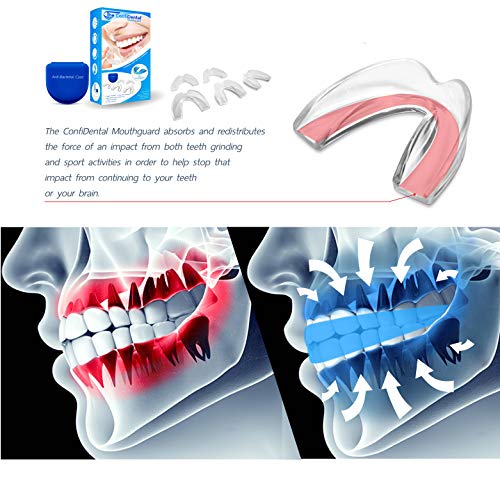 - Pack of 5 Moldable Mouth Guard for Teeth Grinding Clenching Bruxism, Sport Athletic, Whitening Tray, Including 3 Regular and 2 Heavy Duty Guard (3 (lll) Regular 2 (II) Heavy Duty)