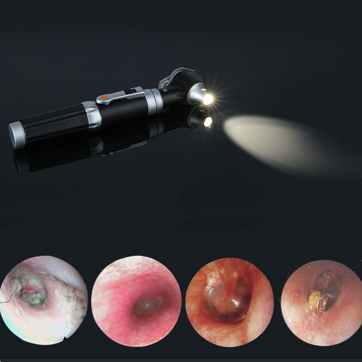 Mini Ear Otoscope, Magnification Diagnostic Ear Scope with LED Direct Illumination Light, Ear Healthy Tool for Doctors Nurses Adults Kids Baby Elder Pets Animals