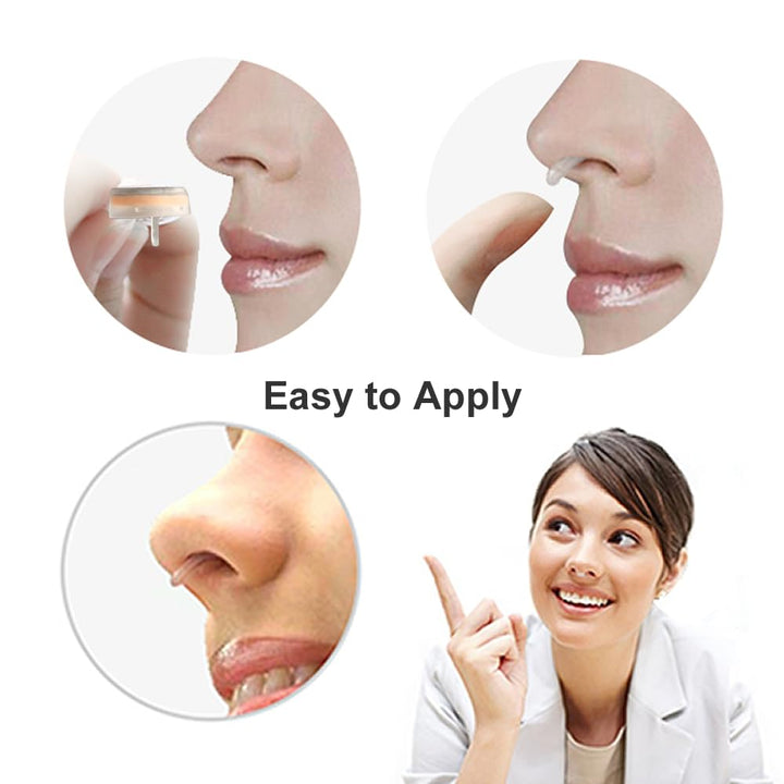 Ultra-Breathable Nasal Filters, Seasonal and dust Allergies aid (Narrow, XL, 6 Pack)