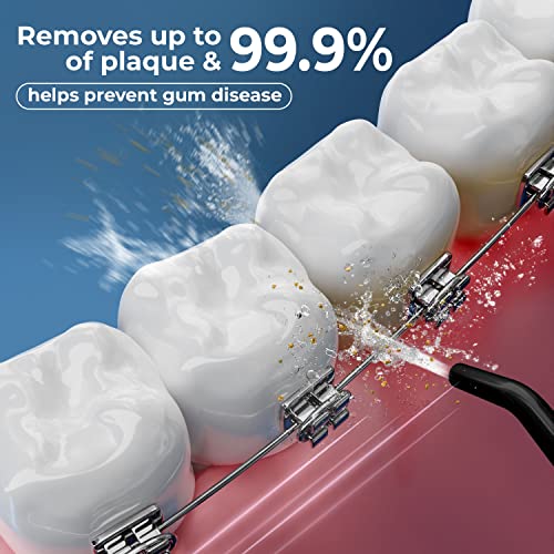 Water Flosser Cordless Pick for Teeth, 4 Modes, Gentle on Gums, Removes Plaque & Food Particles, High-Power, Rechargeable & Waterproof Oral Irrigator; 6 Replacement Tips Included.