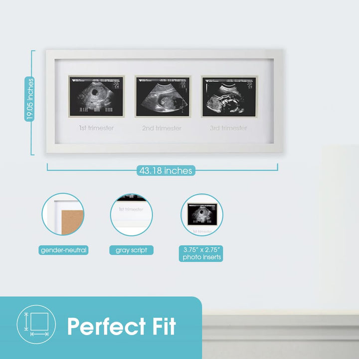 Sonogram Progression Frame - Trimester by Trimester Pregnancy Milestone Keepsake, Gender-Neutral Nursery Decor, Displays 1st, 2nd & 3rd Trimester Ultrasound Photos, White