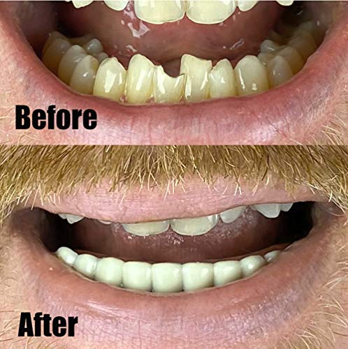 Comfort Fit Flexible Lower Teeth