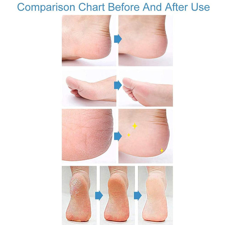 Nature's Miracle Urine Destroyer for Dogs, Light Fresh Scent, Tough on Strong Dog Urine and The Yellow Sticky Residue