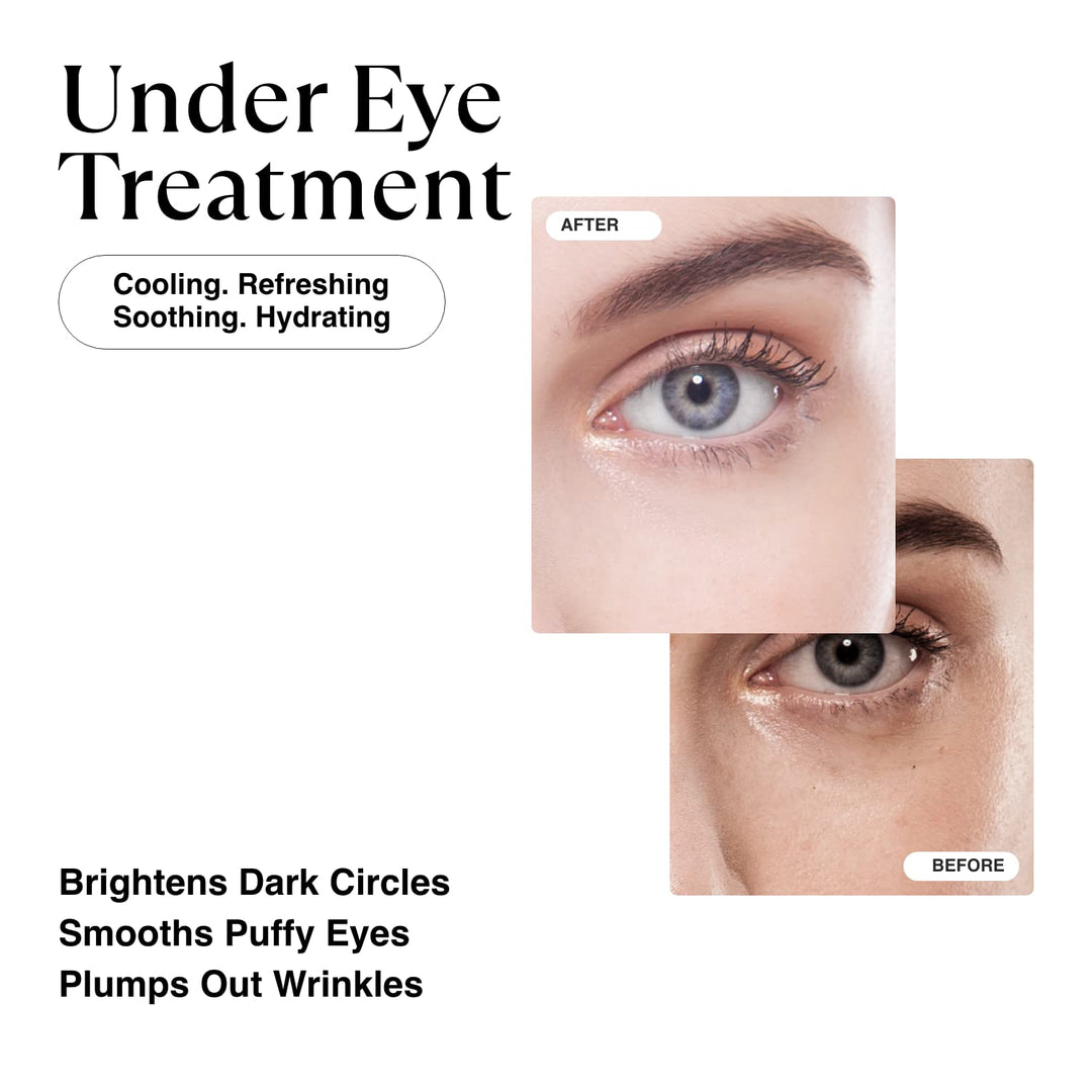 Korean Gold Under Eye Patches for Dark Circles and Puffiness, Wrinkles - Retinol + Hyaluronic Acid + Collagen + Niacinamide, Under Eye Mask Puffy Eyes Treatment for Women Skin Care