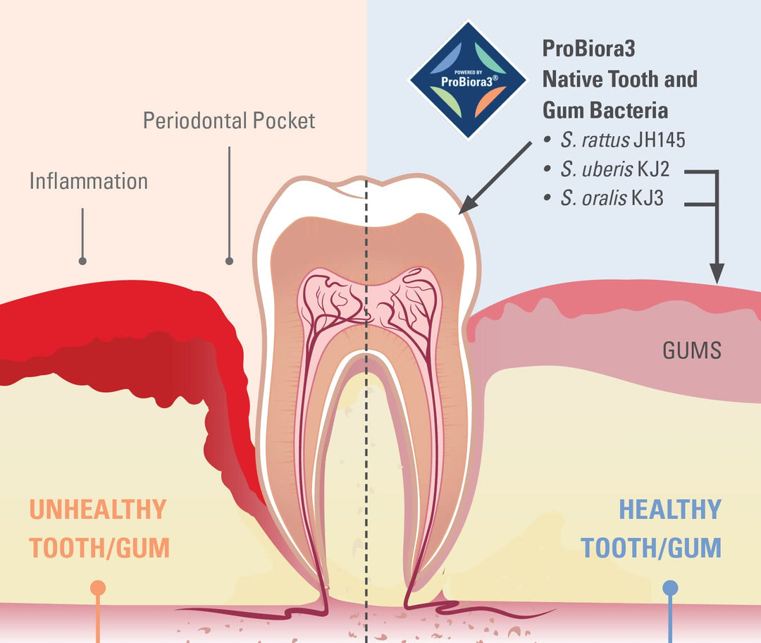 ProBiora Oral Probiotics for Teeth and Gums | Dental Probiotics for Improved Oral Health | Bad Breath Treatment for Adults | ProBiora3 Patented Probiotic Blend | Tooth Whitening | 30 Mint Tablets