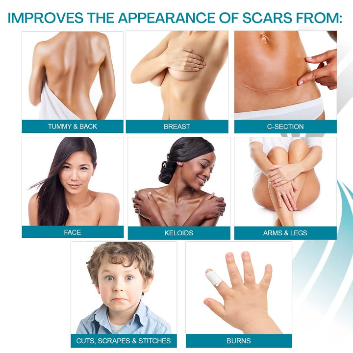 NewGel+E Advanced Silicone Scar Treatment Gel for Old and New Scars w Vitamin E, for Surgery, Injury, Keloids, Burns, and Facial Blemish Scars (15 Grams)