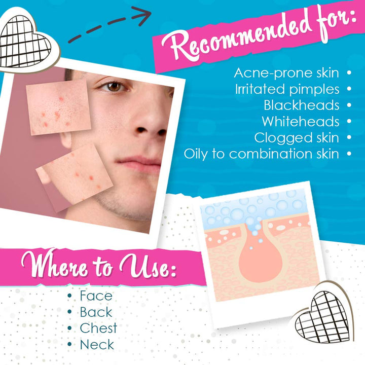 Acne Drying Lotion, Reduce Pimples Overnight 1oz, 1-Pack