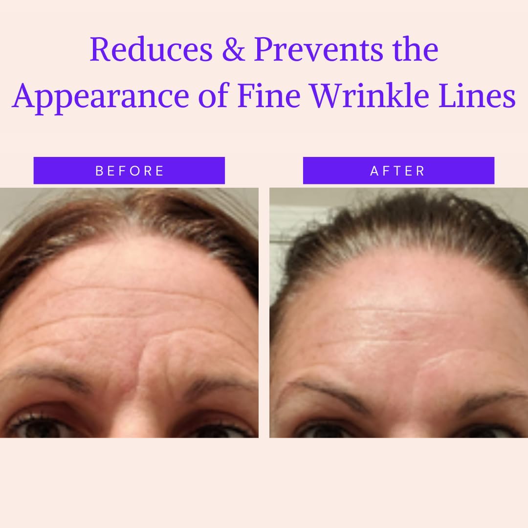 Face & Forehead Wrinkle Patches - Anti Wrinkle Facial Patches to Smooth Eye, Mouth, Forehead Wrinkles - Non-Silicone Face Tape for Fine Wrinkles between Eyes & Face - Patches (30 day supply)
