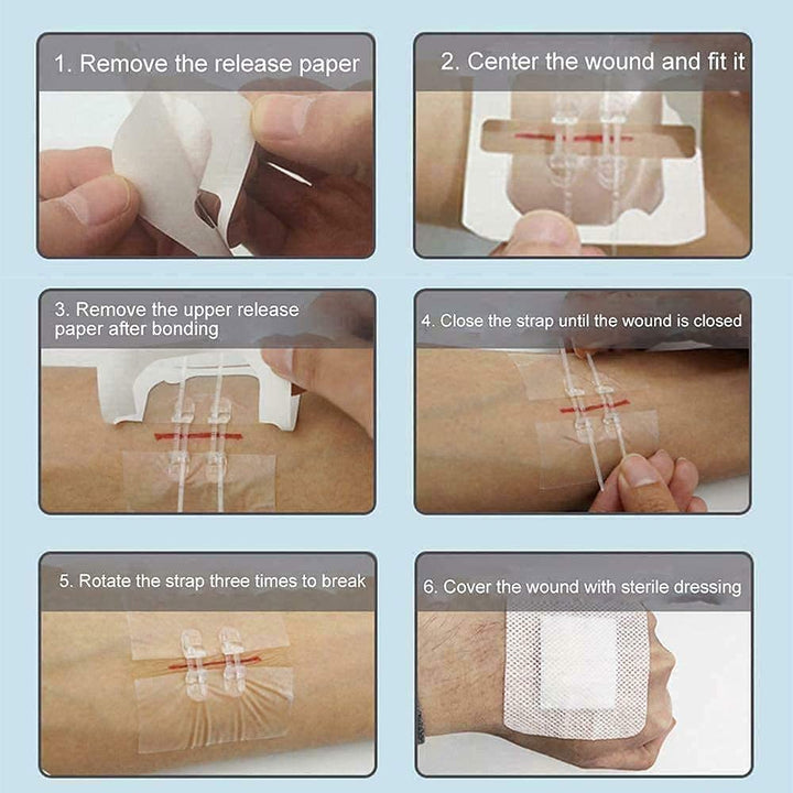 Cavallini Papers 4 Pcs Zip Stitch Sutures, Extra Large Band Aid, Waterproof Butterfly Strips Wound Closure, Hospital Grade Laceration Kit