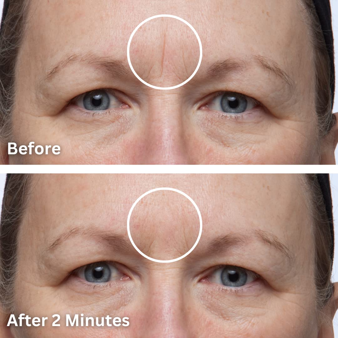Cover Up - Concealer for Scars, Frown Lines from Hollywood Pro