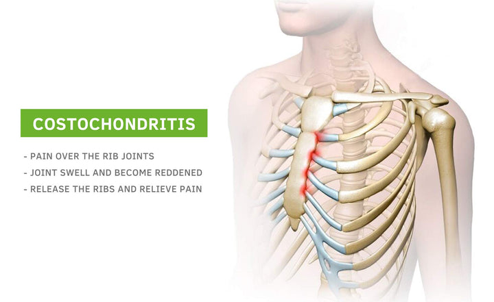 - Upper Back and Headache Pain Relief - treatment for Costochondritis and Tietze Syndromeb-Help Back Stretcher, Posture Corrector