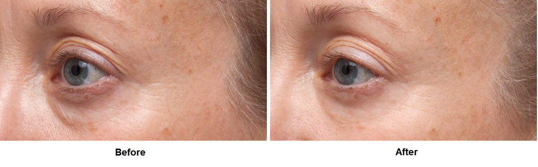Ferulic + Retinol Triple Correction Eye Serum: for Wrinkles, Loss of Elasticity, and Rough Texture, 0.5 fl oz