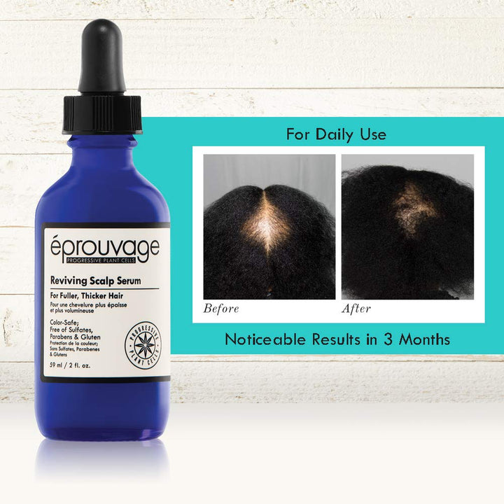 Éprouvage Reviving Scalp Serum – For Thicker, Fuller Hair – Thinning Hair, Hair Loss Treatment – 2 Fl. Oz.