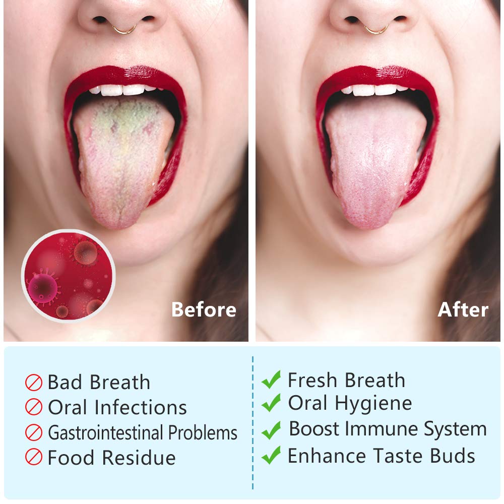 Tongue Scraper Cleaner (4 Pack), Tongue Scrapers for Adults Stainless Steel Tongue Cleaners Reduce Bad Breath Tongue Brush Dental Kit with Case