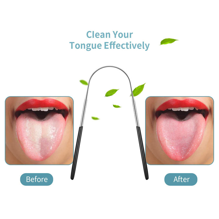 4 Pieces Tongue Cleaners Stainless Steel Tongue Scrapers Oral Tongue Brushes, Red and Black (U Shape, Straight Shape)