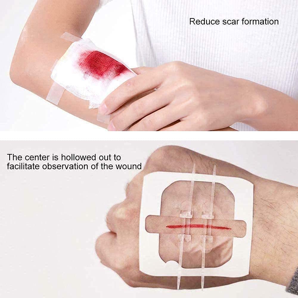 Cavallini Papers 4 Pcs Zip Stitch Sutures, Extra Large Band Aid, Waterproof Butterfly Strips Wound Closure, Hospital Grade Laceration Kit
