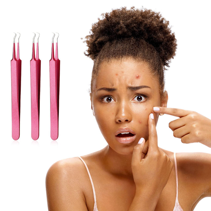 3 Pieces Blackhead Tweezers Acne Blemish Stainless Steel Blemish Extractor Tool for Remove Blackhead Acne Whitehead Pimple Bend Curved Tweezer Skin Blackhead Remover Tools (Rose Red)