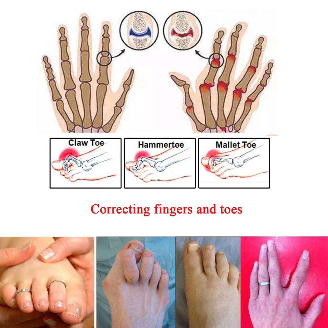 12 Pieces Broken Toe Wraps, Cushioned Bandages, Hammer Toe Separator Splints, Toe Straight, Hammer Toe Wrap, Cushioned Corrector, for Broken Toe, Hammer Toe - L Size
