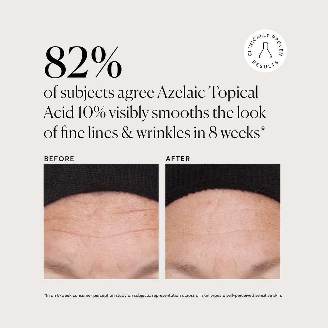 Azelaic Topical Acid 10%, Plus Niacinamide & Vitamin C, Face & Skin Care Treatment, Dark Spot Remover, 1 Oz, Oil