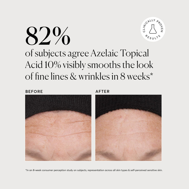 Azelaic Topical Acid 10%, Plus Niacinamide & Vitamin C, Face & Skin Care Treatment, Dark Spot Remover, 1 Oz, Oil