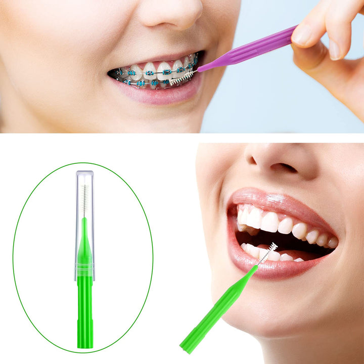 100 Pieces Braces Brush for Cleaner Interdental Brush Toothpick Dental Flossing Head Oral Hygiene Flosser Tooth Cleaning Tool (Stylish Colors)