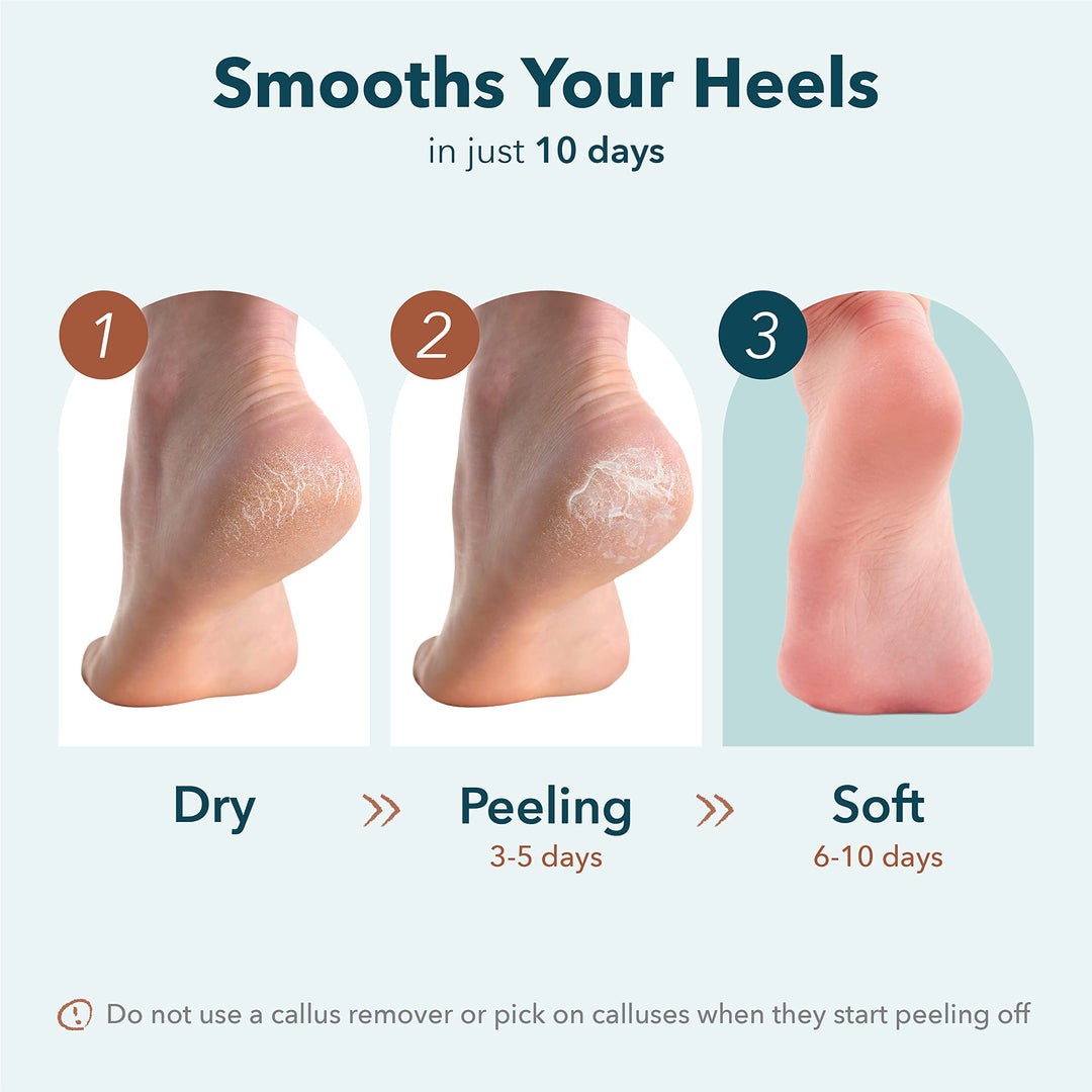 PUREDERM heel mask 0.63oz/ Korean beauty/Exfoliating foot peeling mask, Foot mask, Foot peeling, Removes Dead skin, Foot spa, Self foot care/Heel patch/Moisture foot mask (Exfoliating Heel Mask)