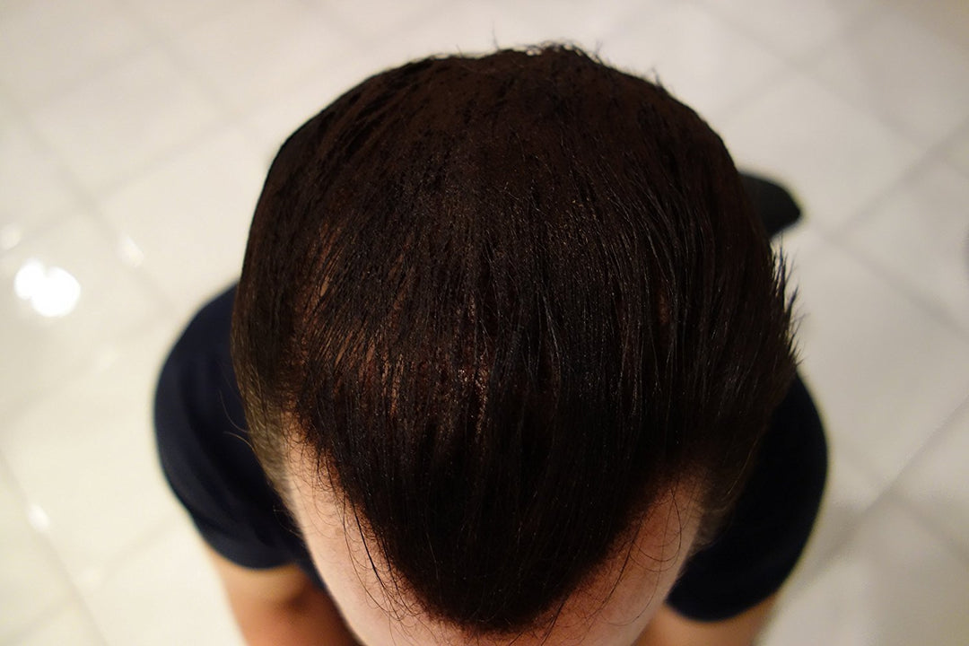 Dark Brown : Hair Building Fibers Dark Brown 25 Grams Refill Your Existing Bottle Highest Grade Dark Brown w/very slight hint of red (use Dark Chocolate Brown for darker with no red)