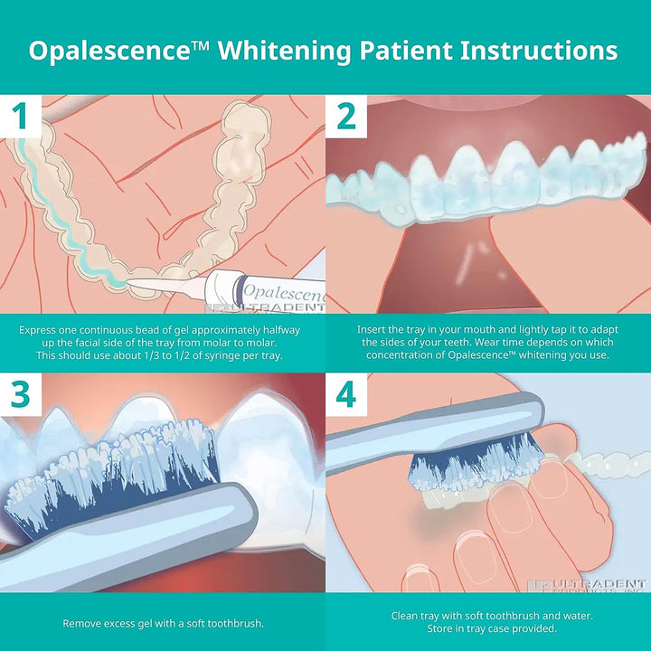20% Teeth Whitening Refill Kit (2 Packs / 4 Syringes) Carbamide Peroxide. Made by Ultradent, in Mint Flavor. Tooth Whitening Refill Syringes - B-5196-4