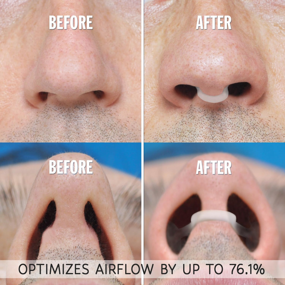 Mack’s Small - Clear: Airmax Nasal Dilator For Better Sleep - Natural, Comfortable, Anti Snoring Device, Snoring Solution For Maximum Airflow And Easier Breathing (Small – Clear)