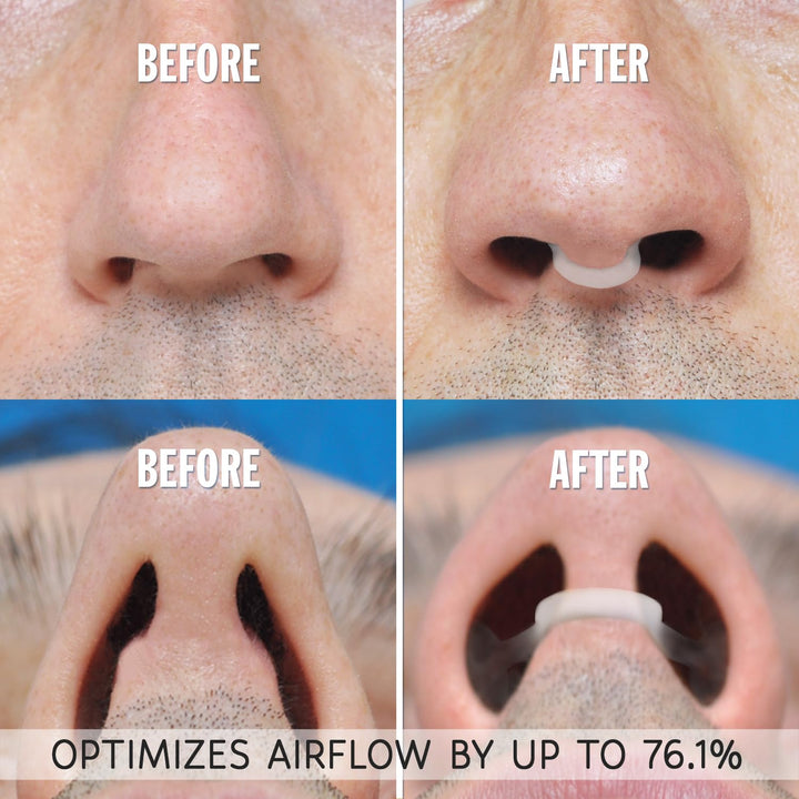 Mack’s Small - Clear: Airmax Nasal Dilator For Better Sleep - Natural, Comfortable, Anti Snoring Device, Snoring Solution For Maximum Airflow And Easier Breathing (Small – Clear)