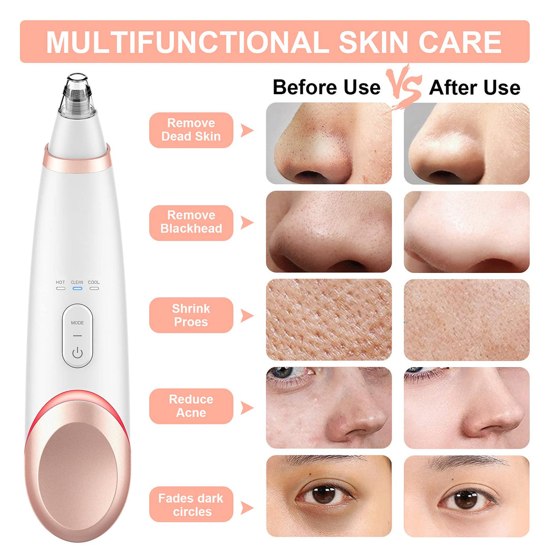 Blackhead Remover Pore Vacuum Hot Cold Compress Eyes Care Electric Facial Deep Cleanser Acne Comedone Whitehead Extractor Tool 4 Suction Power 5 Probes USB Rechargeable pimple Vacuum Kit for Women Men
