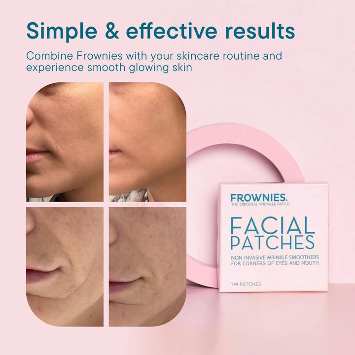 Frownies Facial Patches for Wrinkles on the Corner of Eyes & Mouth - Hypoallergenic Anti-Wrinkle Face Tape - Wrinkle Patch to Smooth & Soften Crow’s Feet & Smile Lines - For Overnight Use, 144 Patches