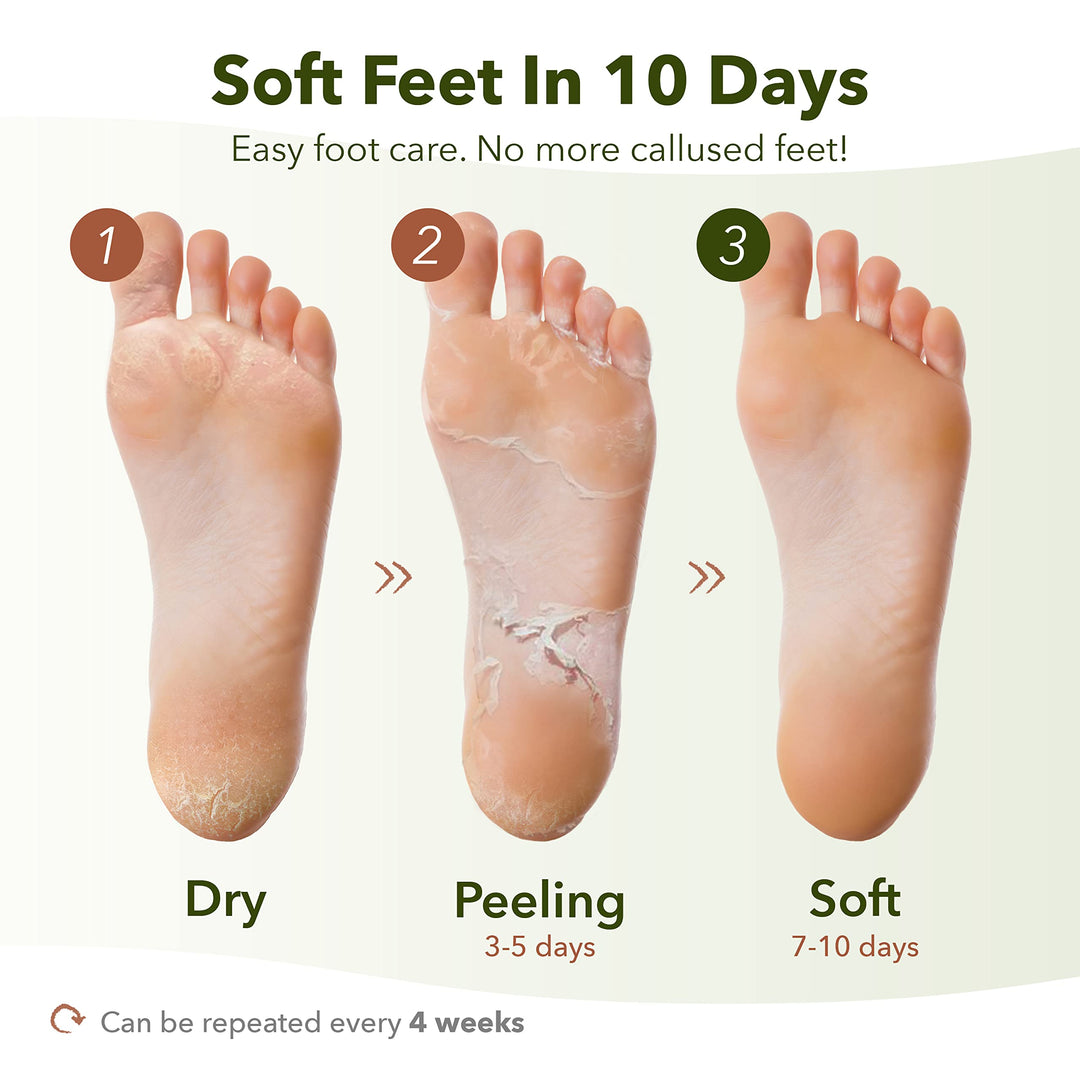 Shiny & Soft Foot Peeling Mask (3 pack) - For smooth and moist baby skin with Exfoliating peel off Calluses, Dry Skin, Cracked Heels - Men and Women
