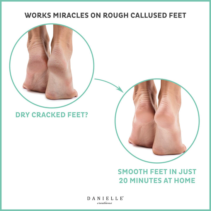 Miracle Nourishing Foot Mask, 2-Pack, 2 Piece