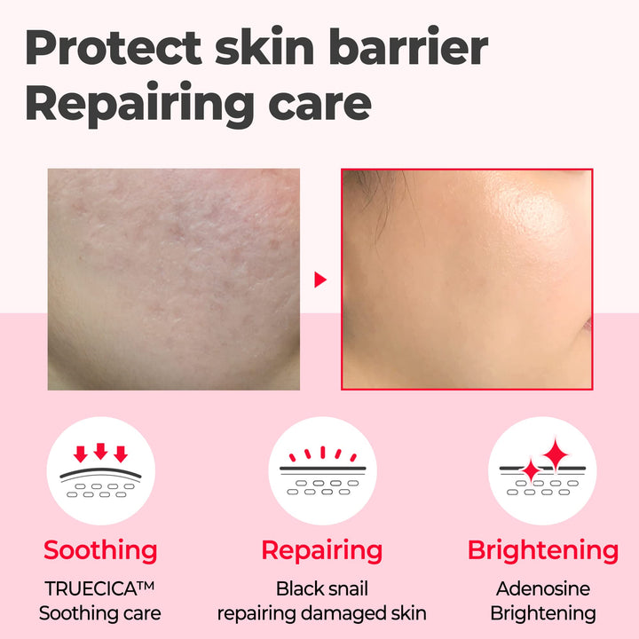 Snail Trucica Miracle Repair Serum - 1.69Oz, 50ml - Made from Snail Mucin for Sensitive Skin - Daily Repair Face Serum for Post Acne Marks and Strengthen Skin Barrier - Korean Skin Care