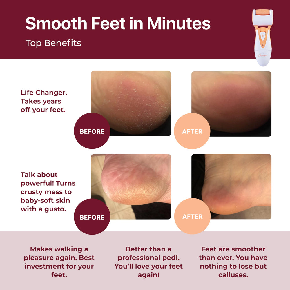 Professional Foot Care for Women: Rechargeable Callus Remover for Feet Electric Foot Sander - Electronic Foot File CR900 with 3 Rollers, Foot Grinder Pedi for Cracked Heels & Hard Skin