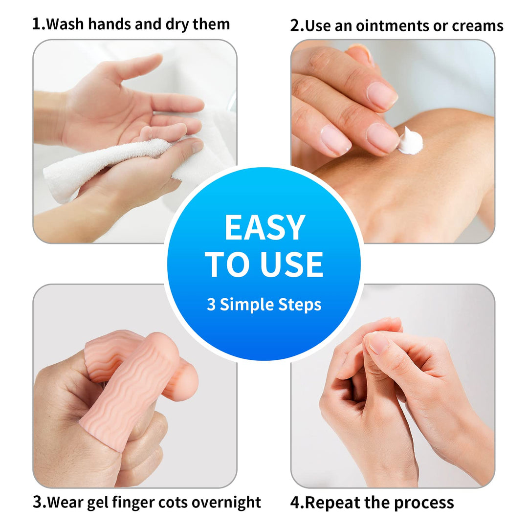 12 PCS Finger Cots - Finger Protectors Gel Finger Gloves Covers Fingertip Sleeves Guards for Cracked Skin, Trigger Finger and More, Large Size
