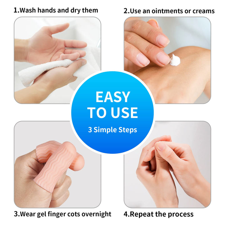 12 PCS Finger Cots - Finger Protectors Gel Finger Gloves Covers Fingertip Sleeves Guards for Cracked Skin, Trigger Finger and More, Large Size